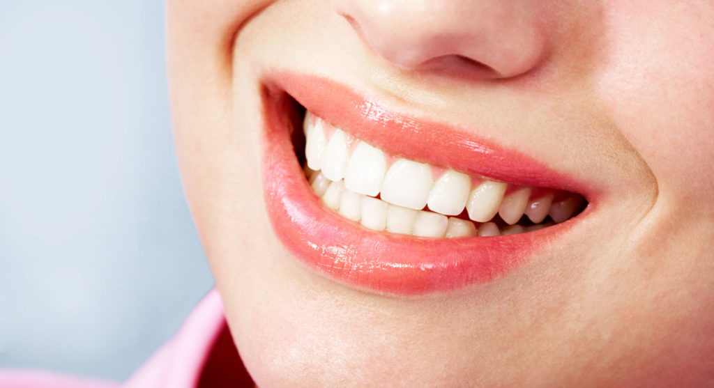 Blanqueamiento dental Fuengirola