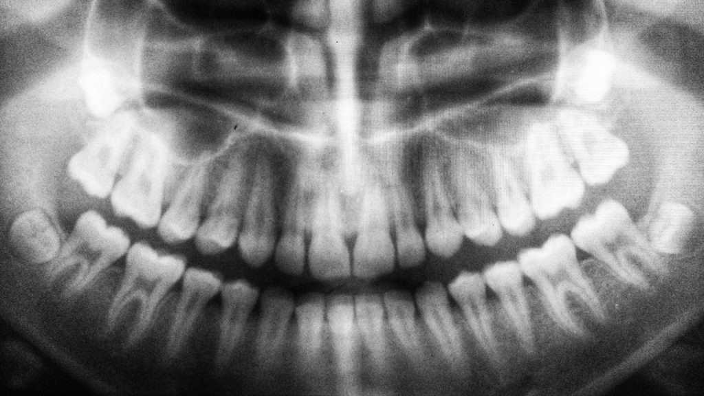 Cirugía en Mijas y Fuengirola - Clínica Ana Claros