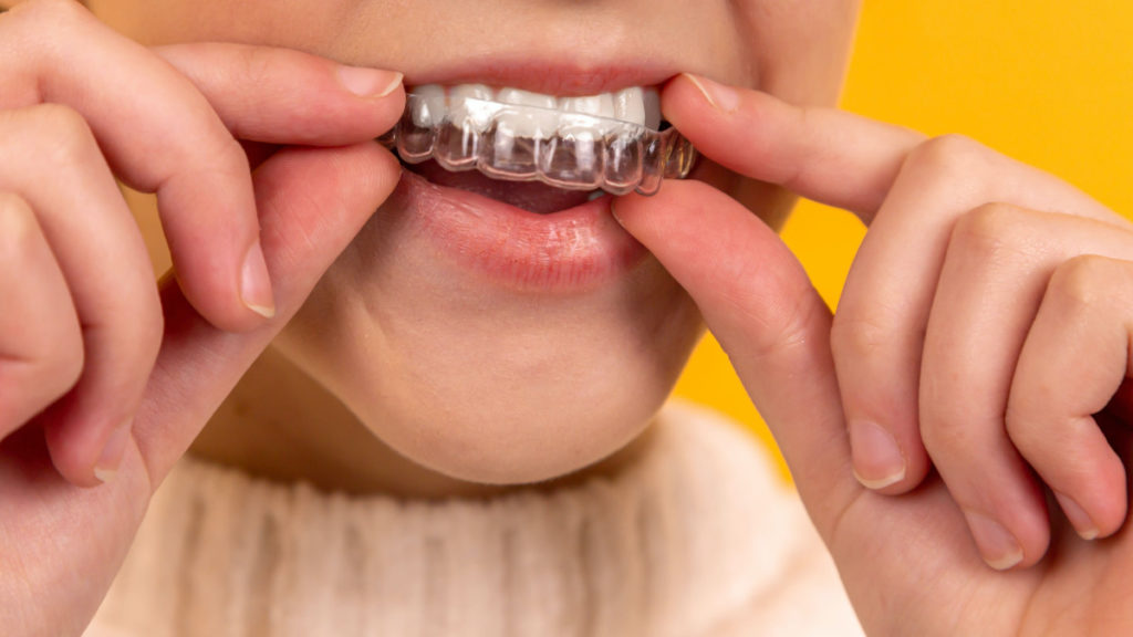 Ortodoncia invisible ventajas