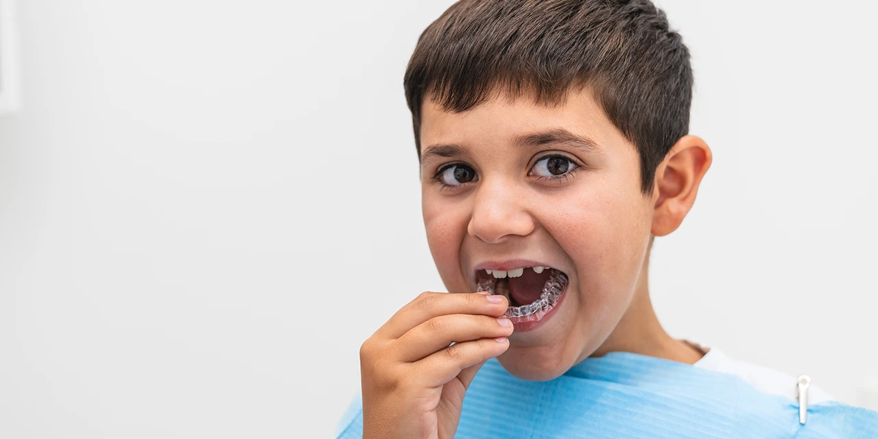 ¿Cuánto dura un tratamiento con alineadores en niños?