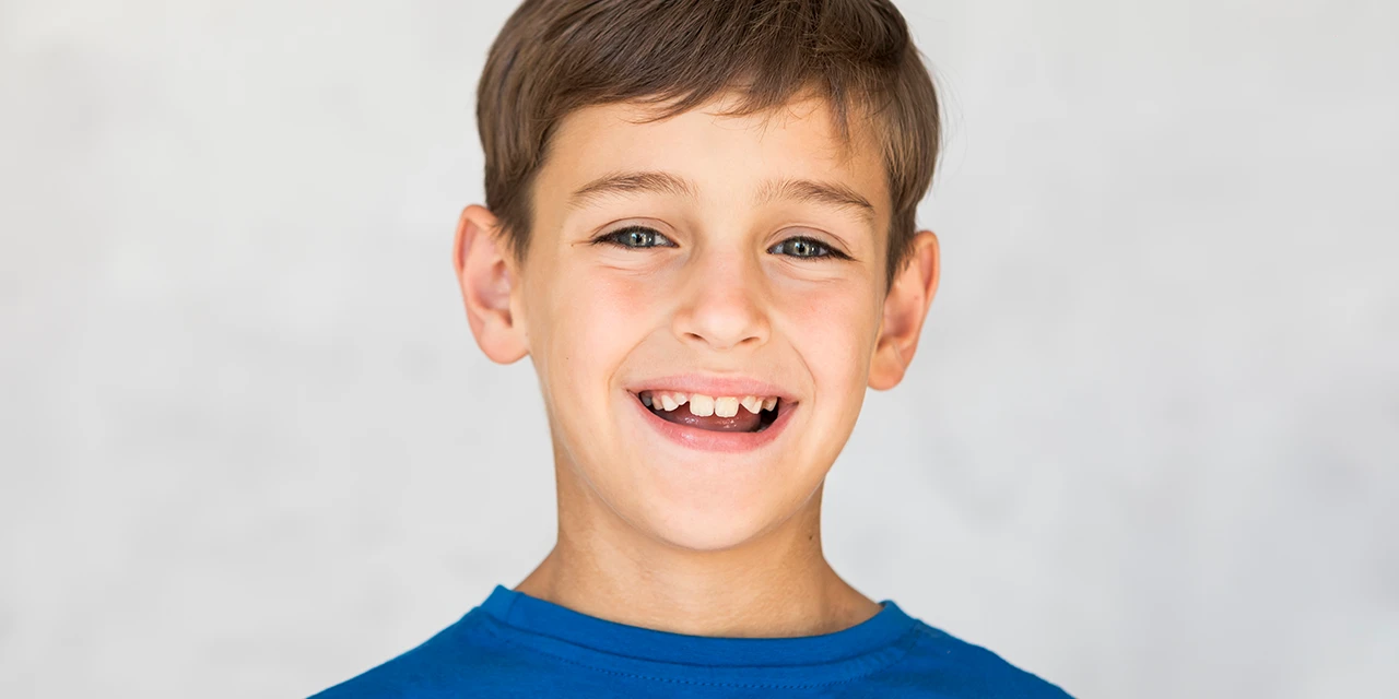 Señales de alerta a los 7 años que indican valoración ortodóncica