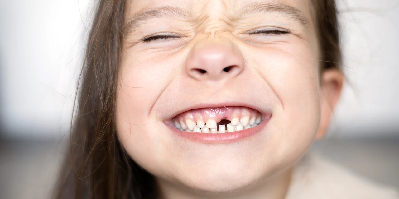 ¿Mi hijo necesita ortodoncia aunque no tenga los dientes torcidos?