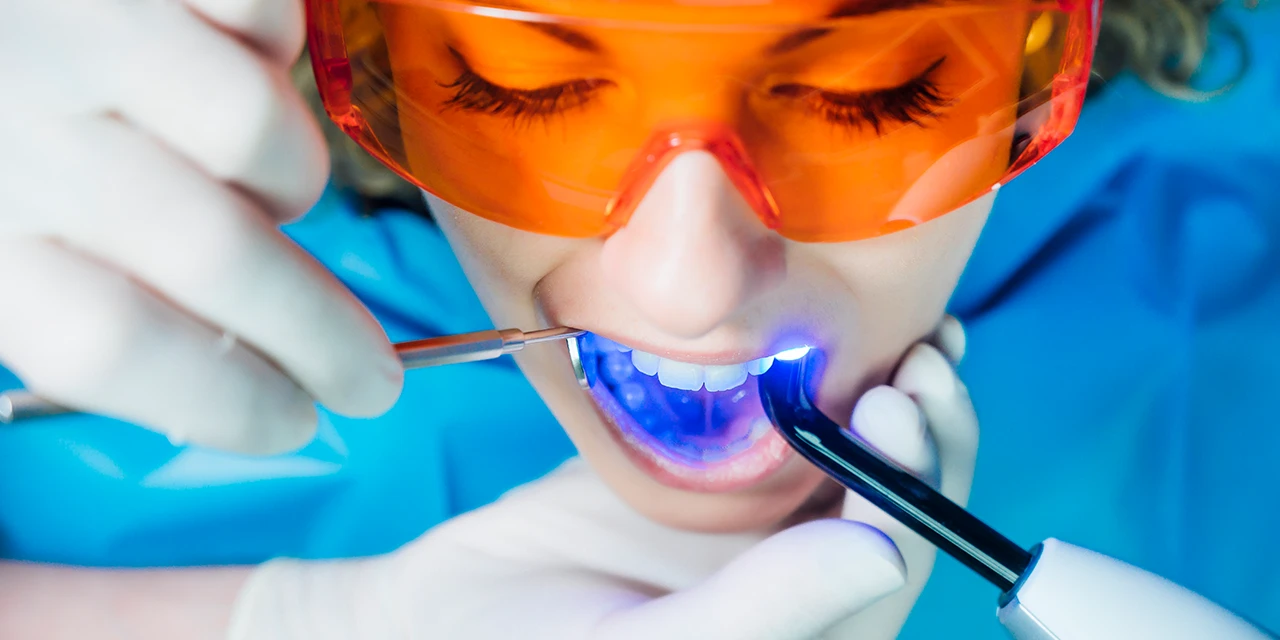 ¿El blanqueamiento dental daña el esmalte? Mitos y verdades